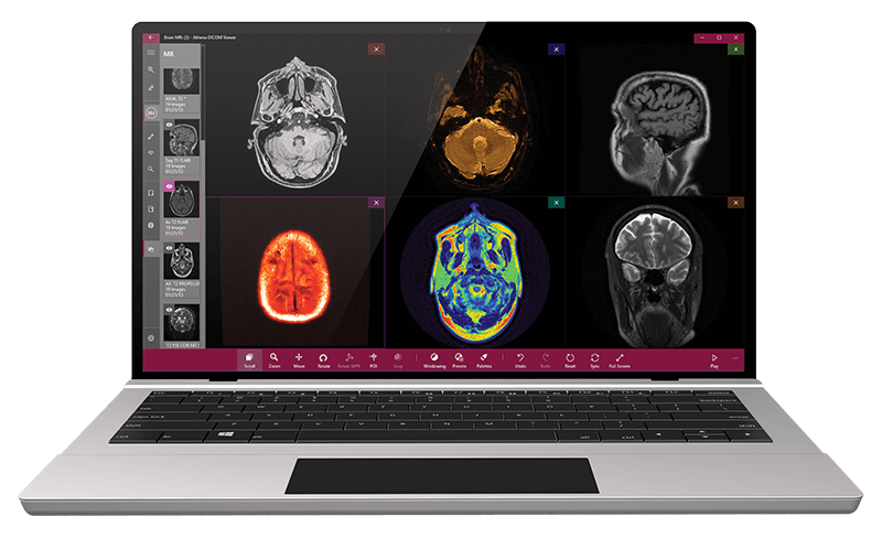 AthenaDicomViewer - Created by PostDICOM